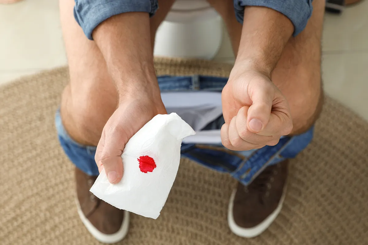 Symptome Entzündungen im Analbereich Eine männliche Person auf einer Toilette mit dem Fokus auf ein blutiges Klopapier in der Hand